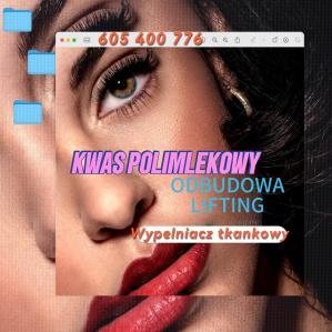 kwas-polimlekowyf09100340711114658